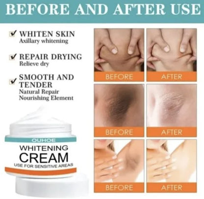 Sensitive Area Whitening Cream For Private Parts, Underarms, Inner Thighs,